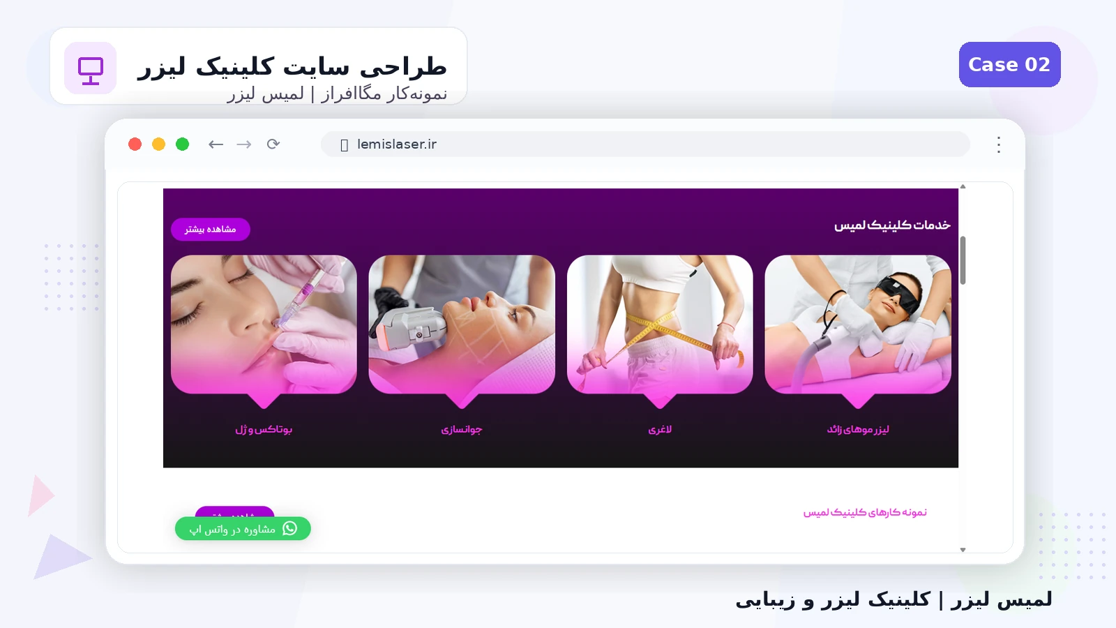 لمیس لیزر - تصویر 2