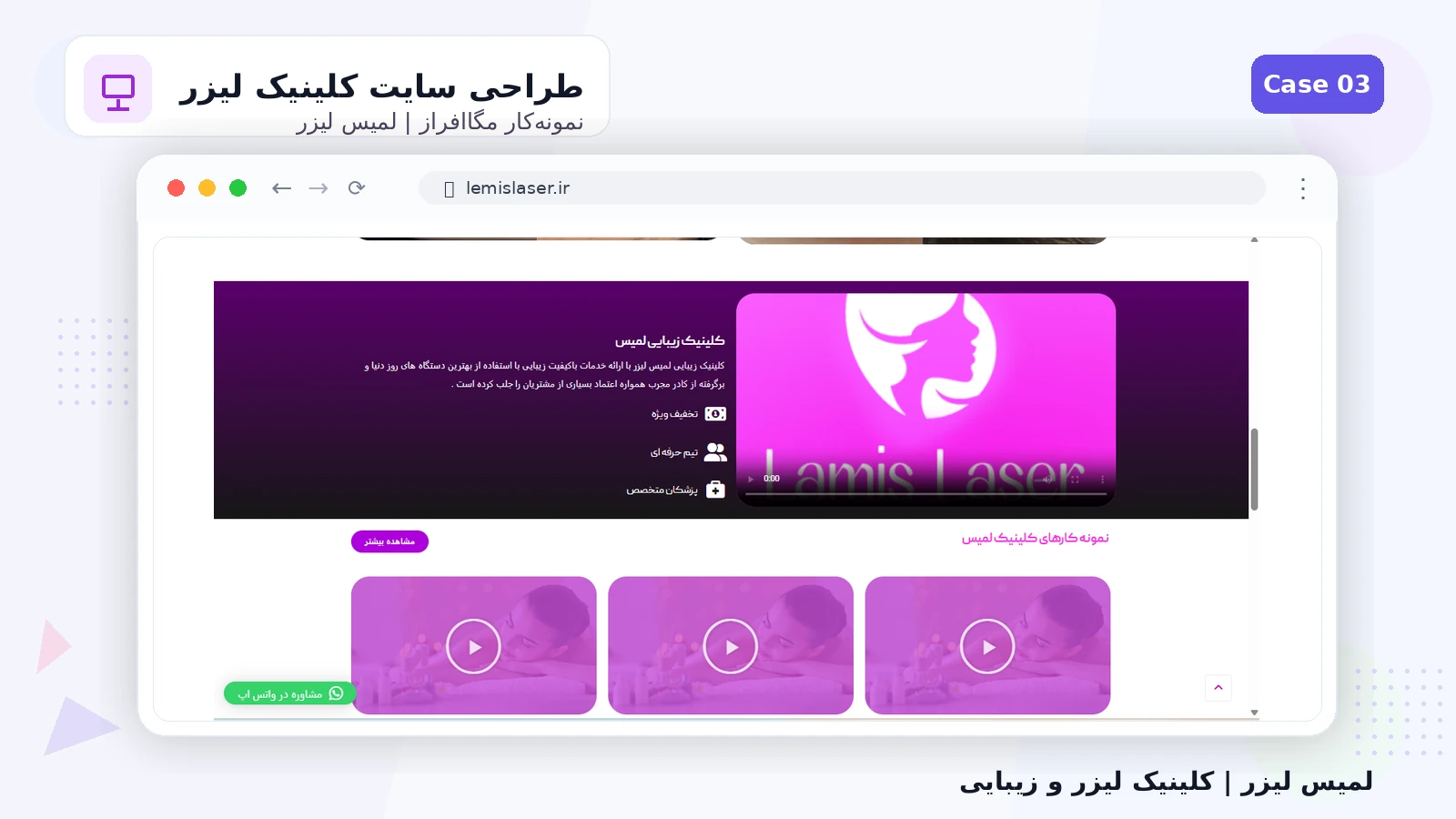 لمیس لیزر - تصویر 3